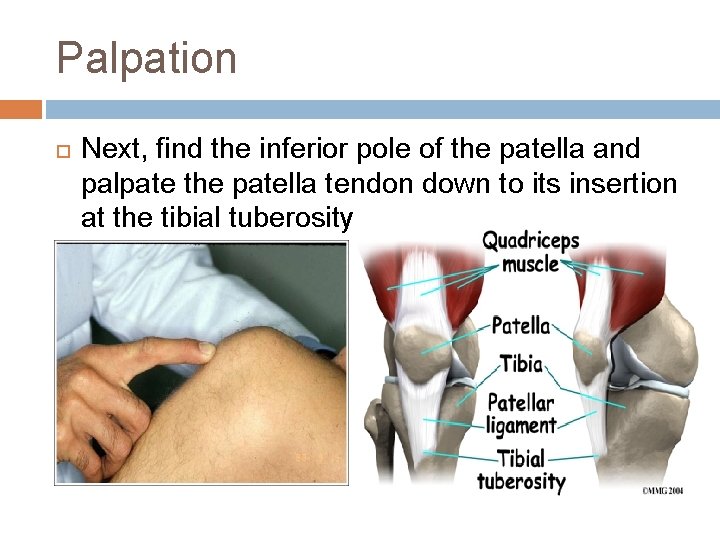 Palpation Next, find the inferior pole of the patella and palpate the patella tendon