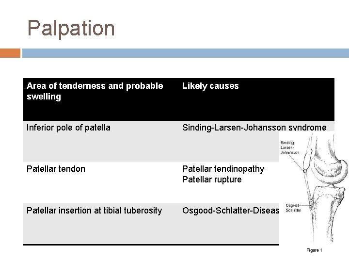 Palpation Area of tenderness and probable swelling Likely causes Inferior pole of patella Sinding-Larsen-Johansson