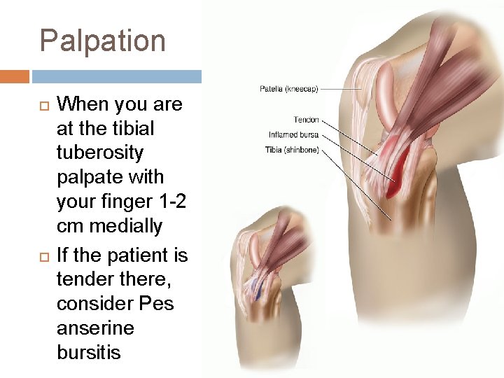 Palpation When you are at the tibial tuberosity palpate with your finger 1 -2