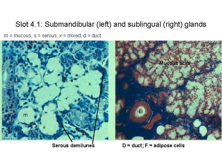 Slot 4. 1: Submandibular (left) and sublingual (right) glands m = mucous, s =