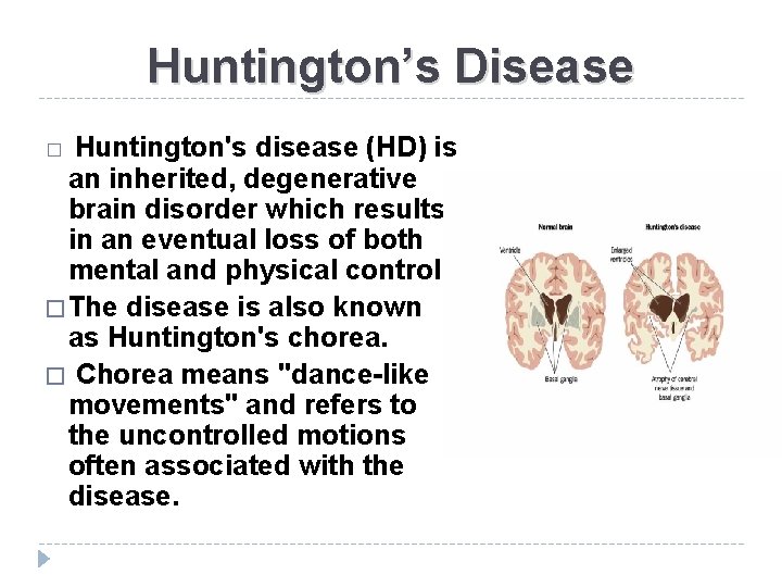 Huntington’s Disease � Huntington's disease (HD) is an inherited, degenerative brain disorder which results
