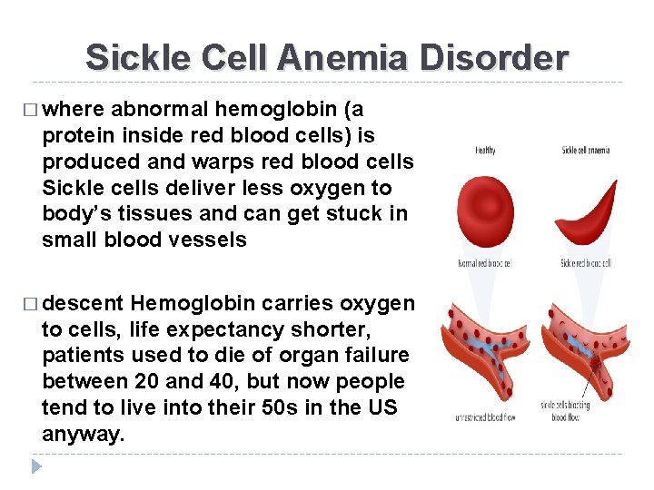 Sickle Cell Anemia Disorder � where abnormal hemoglobin (a protein inside red blood cells)