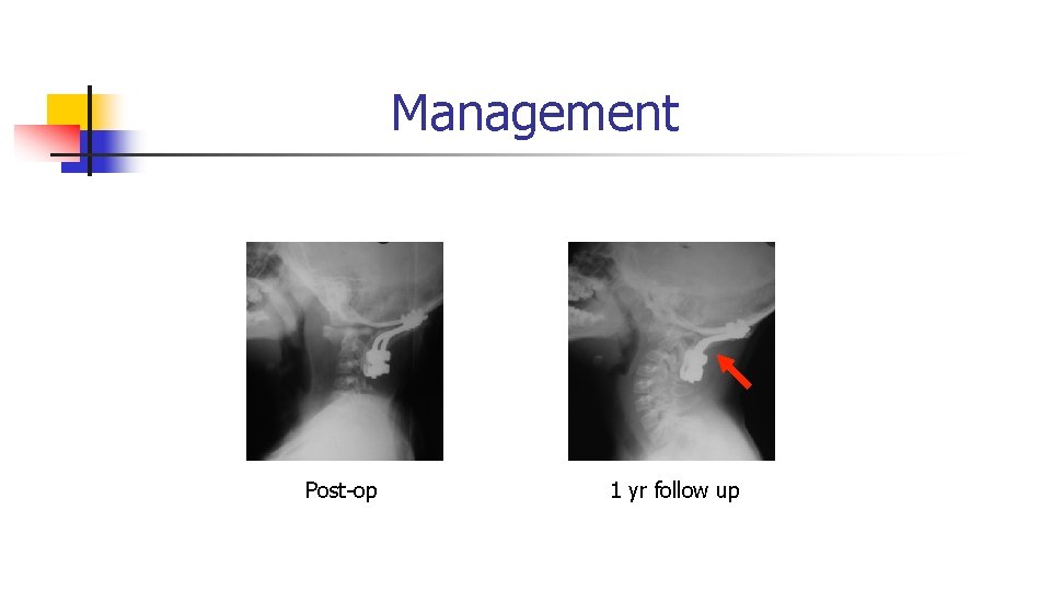 Management Post-op 1 yr follow up Management Post-op 1 yr follow up