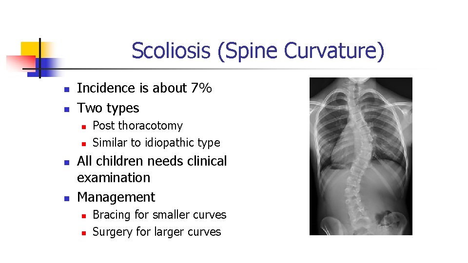 Scoliosis (Spine Curvature) n n Incidence is about 7% Two types n n Post Scoliosis (Spine Curvature) n n Incidence is about 7% Two types n n Post