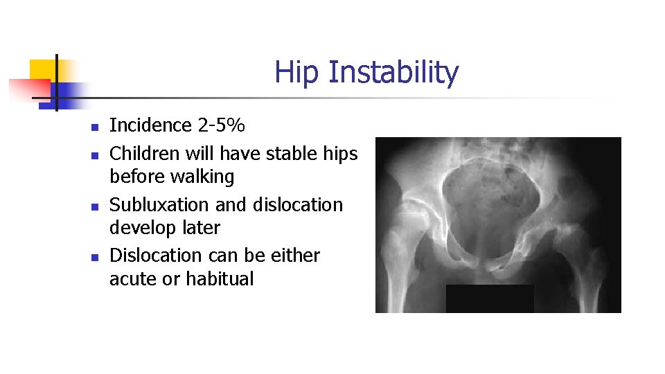 Hip Instability n n Incidence 2 -5% Children will have stable hips before walking Hip Instability n n Incidence 2 -5% Children will have stable hips before walking