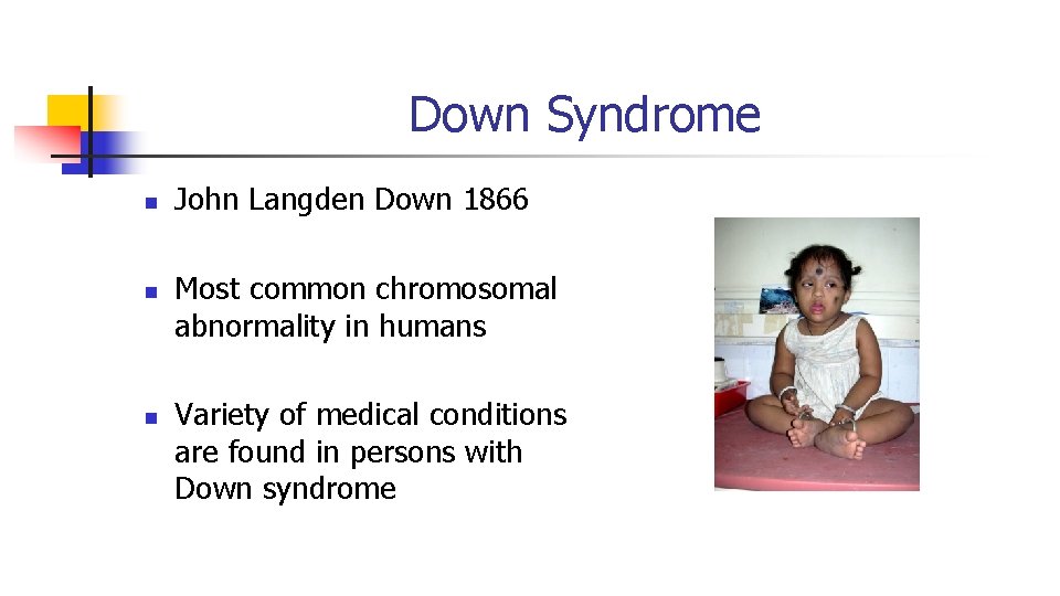 Down Syndrome n n n John Langden Down 1866 Most common chromosomal abnormality in Down Syndrome n n n John Langden Down 1866 Most common chromosomal abnormality in