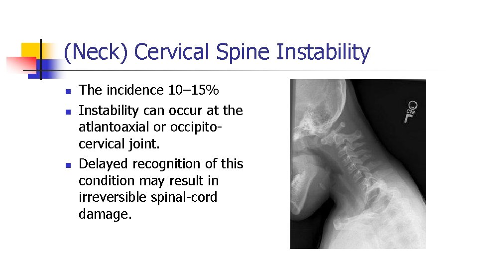(Neck) Cervical Spine Instability n n n The incidence 10– 15% Instability can occur (Neck) Cervical Spine Instability n n n The incidence 10– 15% Instability can occur