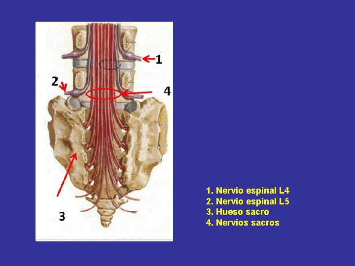 1. Nervio espinal L 4 2. Nervio espinal L 5 3. Hueso sacro 4.