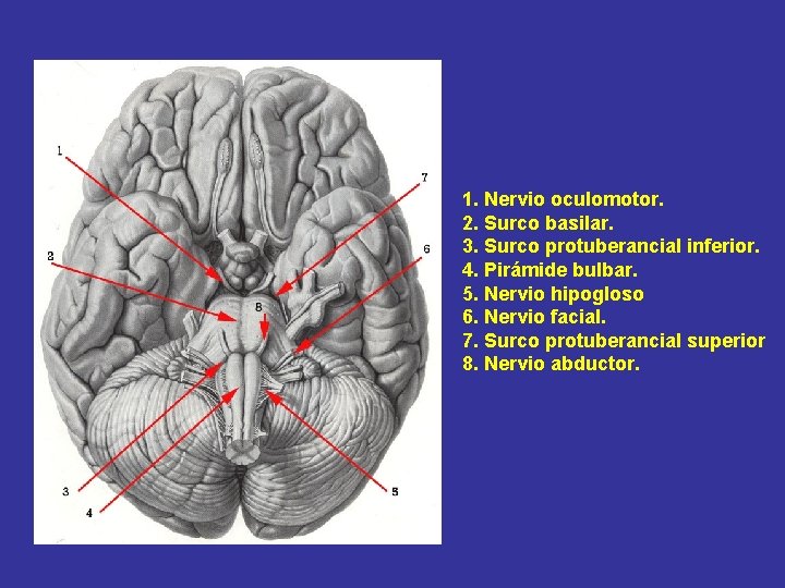 1. Nervio oculomotor. 2. Surco basilar. 3. Surco protuberancial inferior. 4. Pirámide bulbar. 5.