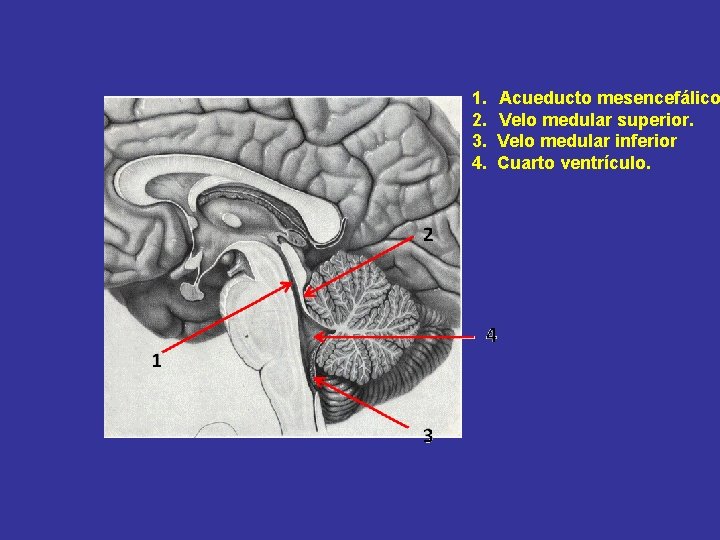 1. 2. 3. 4. Acueducto mesencefálico Velo medular superior. Velo medular inferior Cuarto ventrículo.