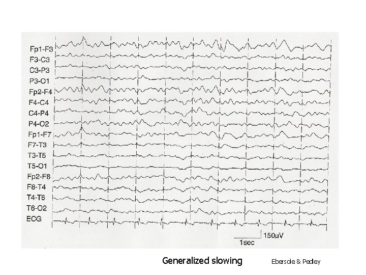 Generalized slowing Ebersole & Pedley 