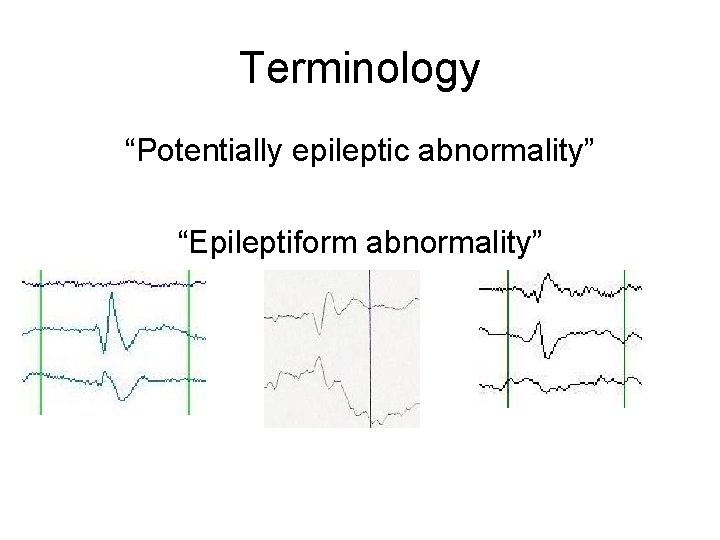 Terminology “Potentially epileptic abnormality” “Epileptiform abnormality” Terminology “Potentially epileptic abnormality” “Epileptiform abnormality”