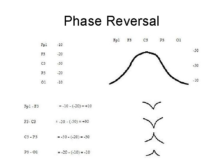 Phase Reversal 