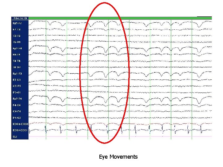 Eye Movements Eye Movements
