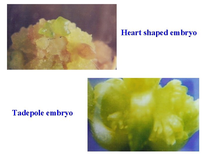 Heart shaped embryo Tadepole embryo 