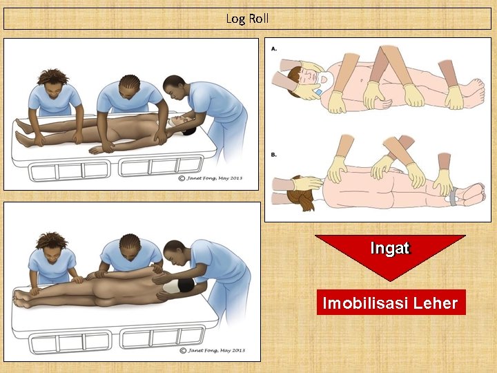 Log Roll Ingat Imobilisasi Leher 