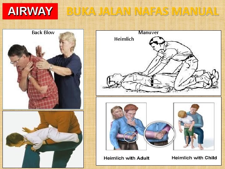 AIRWAY Back Blow BUKA JALAN NAFAS MANUAL Heimlich Manuver 