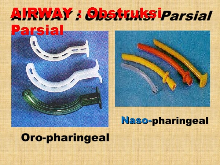 AIRWAY : Obstruksi Parsial Naso- 