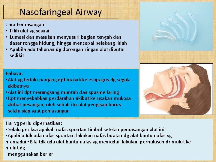 Nasofaringeal Airway Cara Pemasangan: • Pilih alat yg sesuai • Lumasi dan masukan menyusuri