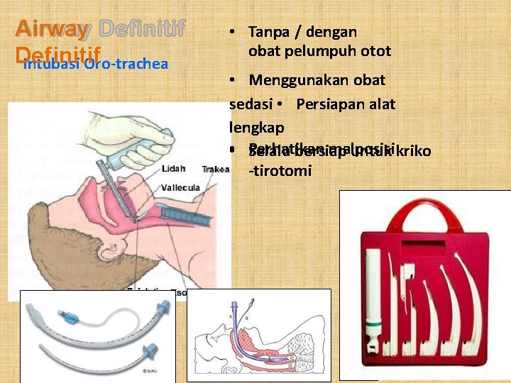 Airway Definitif Intubasi Oro-trachea • Tanpa / dengan obat pelumpuh otot • Menggunakan obat