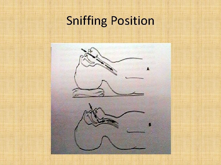 Sniffing Position 