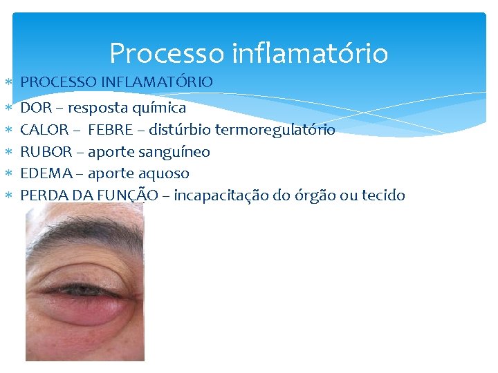 Processo inflamatório PROCESSO INFLAMATÓRIO DOR – resposta química CALOR – FEBRE – distúrbio termoregulatório