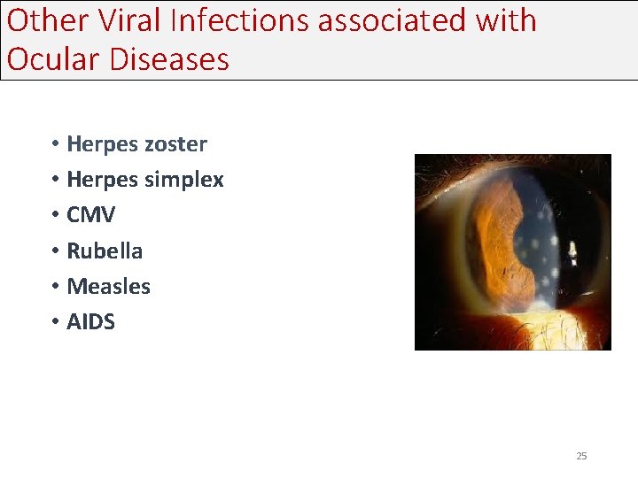 Other Viral Infections associated with Ocular Diseases • Herpes zoster • Herpes simplex • Other Viral Infections associated with Ocular Diseases • Herpes zoster • Herpes simplex •
