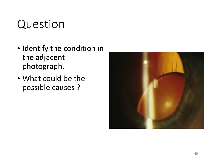 Question • Identify the condition in the adjacent photograph. • What could be the Question • Identify the condition in the adjacent photograph. • What could be the