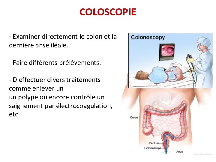 COLOSCOPIE - Examiner directement le colon et la dernière anse iléale. - Faire différents COLOSCOPIE - Examiner directement le colon et la dernière anse iléale. - Faire différents