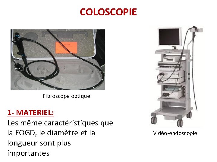 COLOSCOPIE Fibroscope optique 1 - MATERIEL: Les même caractéristiques que la FOGD, le diamètre COLOSCOPIE Fibroscope optique 1 - MATERIEL: Les même caractéristiques que la FOGD, le diamètre