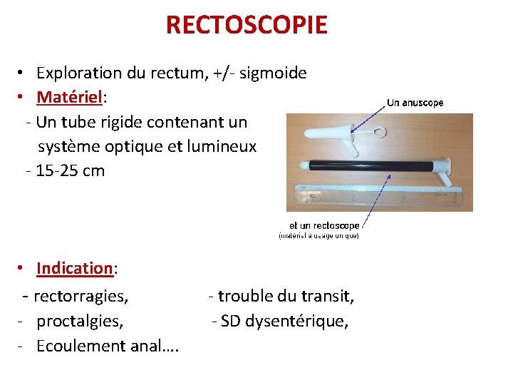 RECTOSCOPIE • Exploration du rectum, +/- sigmoide • Matériel: - Un tube rigide contenant RECTOSCOPIE • Exploration du rectum, +/- sigmoide • Matériel: - Un tube rigide contenant
