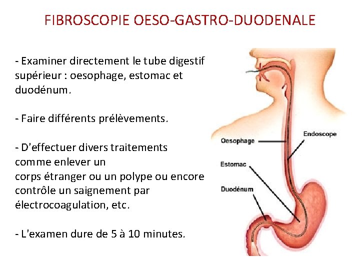 FIBROSCOPIE OESO-GASTRO-DUODENALE - Examiner directement le tube digestif supérieur : oesophage, estomac et duodénum. FIBROSCOPIE OESO-GASTRO-DUODENALE - Examiner directement le tube digestif supérieur : oesophage, estomac et duodénum.