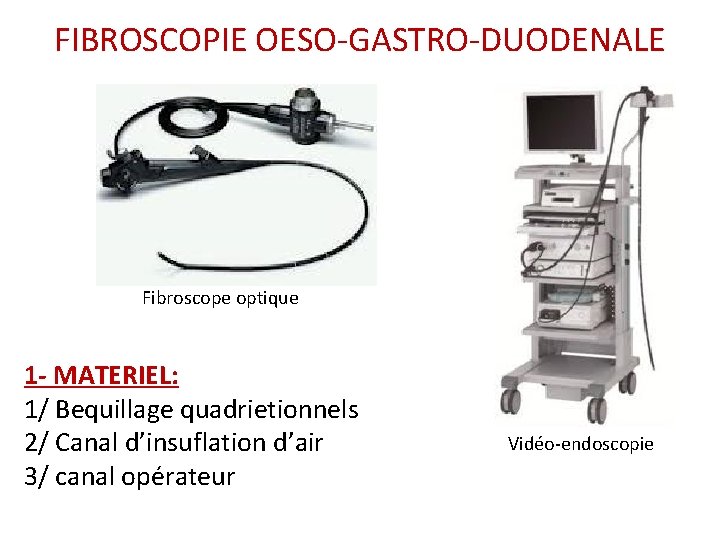 FIBROSCOPIE OESO-GASTRO-DUODENALE Fibroscope optique 1 - MATERIEL: 1/ Bequillage quadrietionnels 2/ Canal d’insuflation d’air FIBROSCOPIE OESO-GASTRO-DUODENALE Fibroscope optique 1 - MATERIEL: 1/ Bequillage quadrietionnels 2/ Canal d’insuflation d’air
