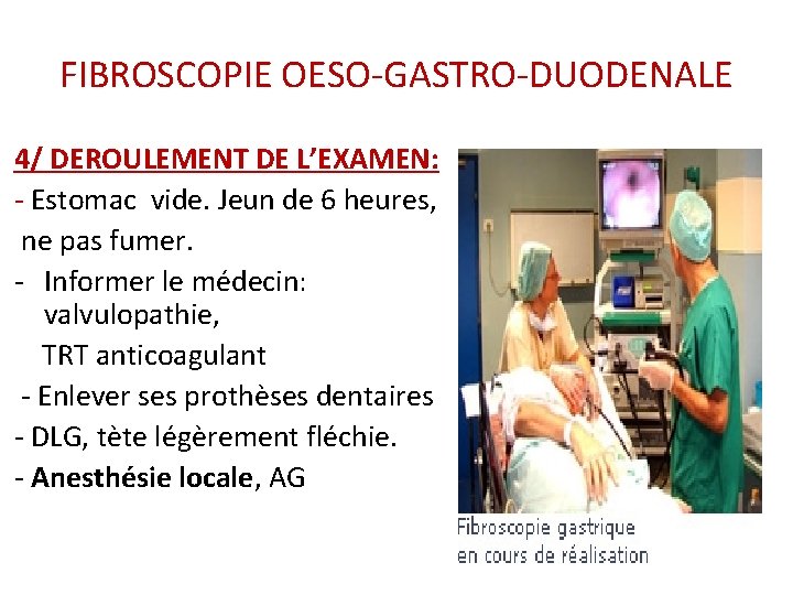 FIBROSCOPIE OESO-GASTRO-DUODENALE 4/ DEROULEMENT DE L’EXAMEN: - Estomac vide. Jeun de 6 heures, ne FIBROSCOPIE OESO-GASTRO-DUODENALE 4/ DEROULEMENT DE L’EXAMEN: - Estomac vide. Jeun de 6 heures, ne