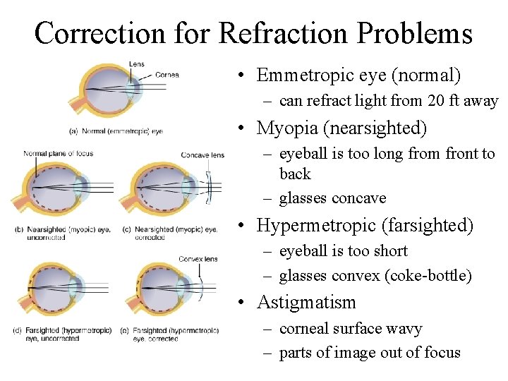 Correction for Refraction Problems • Emmetropic eye (normal) – can refract light from 20