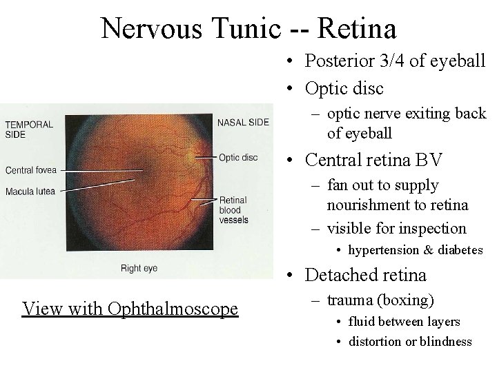 Nervous Tunic -- Retina • Posterior 3/4 of eyeball • Optic disc – optic