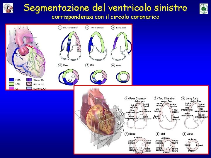 Segmentazione del ventricolo sinistro corrispondenza con il circolo coronarico 