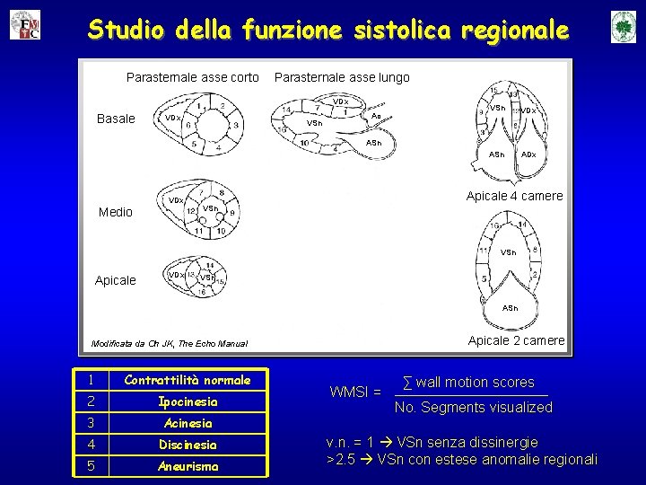 Studio della funzione sistolica regionale Parasternale asse corto Parasternale asse lungo VDx Basale VDx