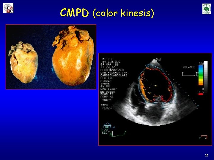 CMPD (color kinesis) 29 CMPD (color kinesis) 29