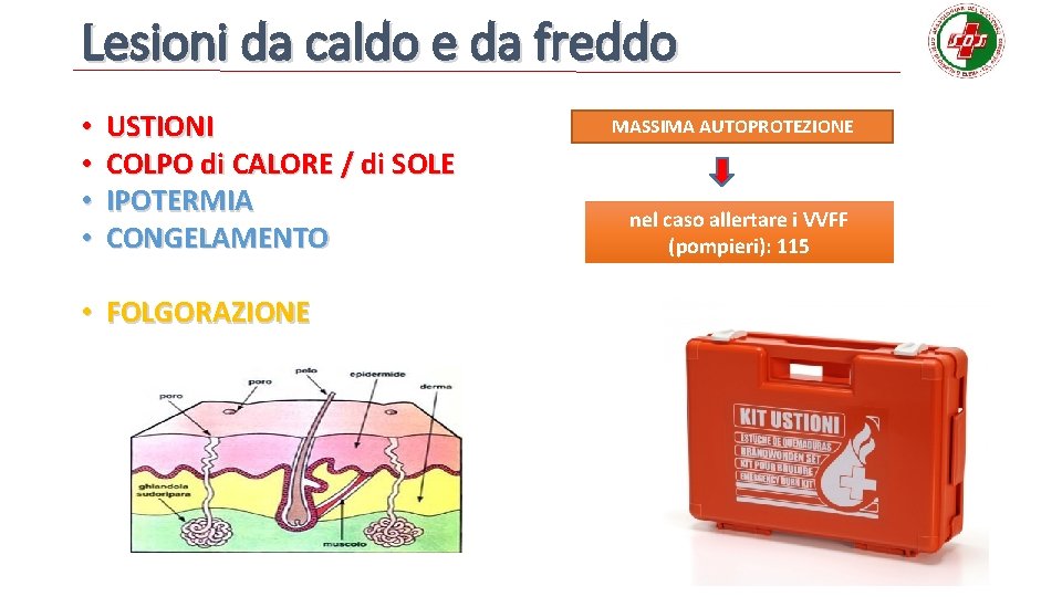 Lesioni da caldo e da freddo • • USTIONI COLPO di CALORE / di