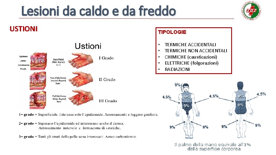 Lesioni da caldo e da freddo USTIONI TIPOLOGIE • • • TERMICHE ACCIDENTALI TERMICHE