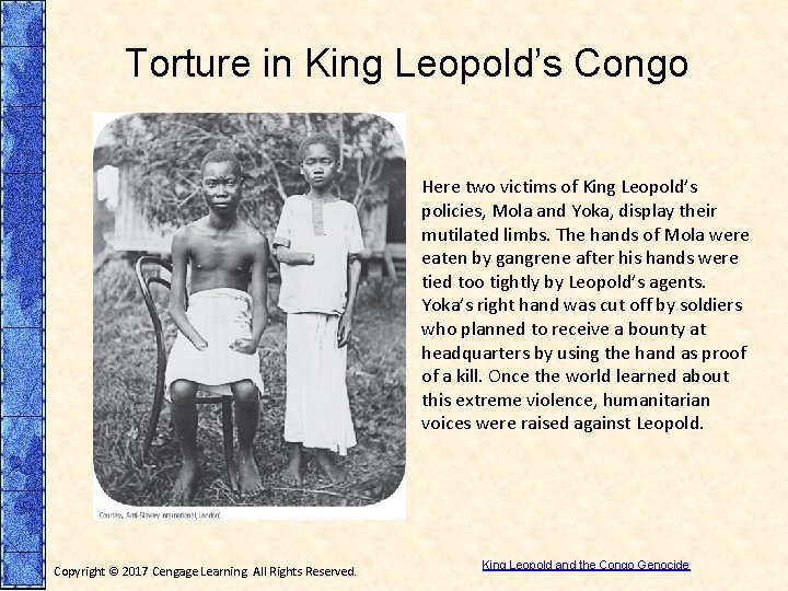 Torture in King Leopold’s Congo Here two victims of King Leopold’s policies, Mola and