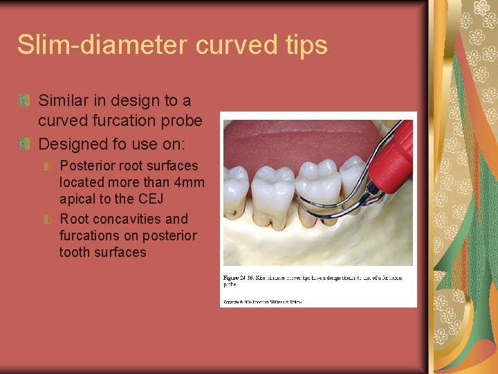 Slim-diameter curved tips Similar in design to a curved furcation probe Designed fo use