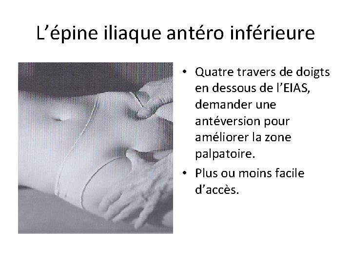 L’épine iliaque antéro inférieure • Quatre travers de doigts en dessous de l’EIAS, demander