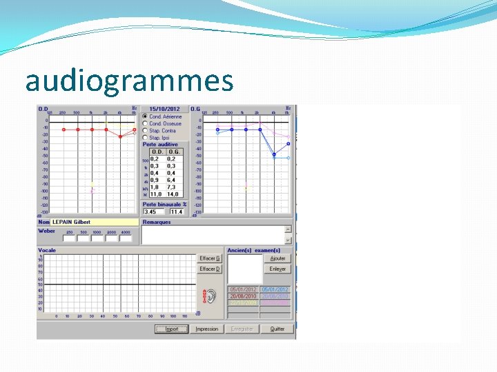 audiogrammes 