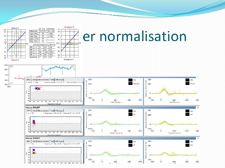 Début février normalisation 