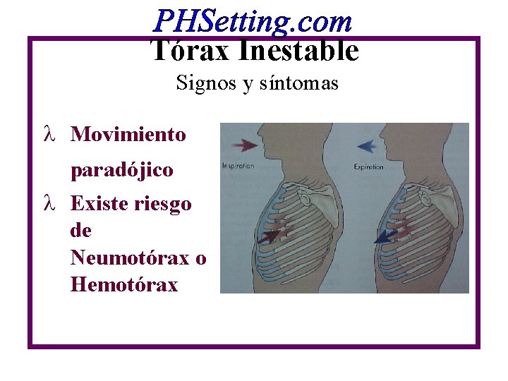Trauma Torcico LESIN TORCICA HIPOXIA TISULAR Oxigenacin inadecuada