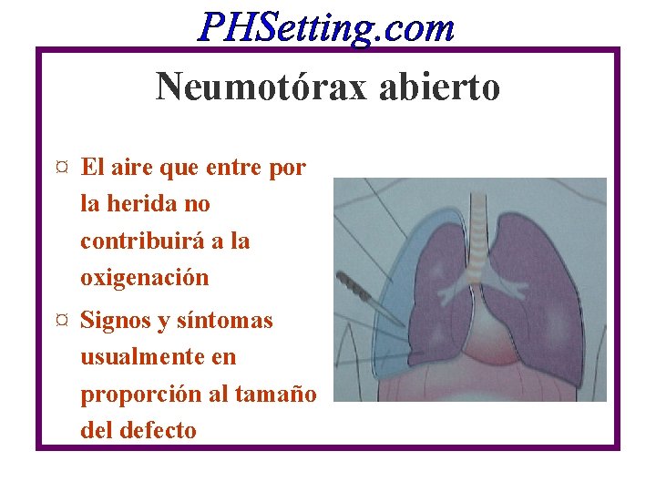 Neumotórax abierto ¤ El aire que entre por la herida no contribuirá a la Neumotórax abierto ¤ El aire que entre por la herida no contribuirá a la