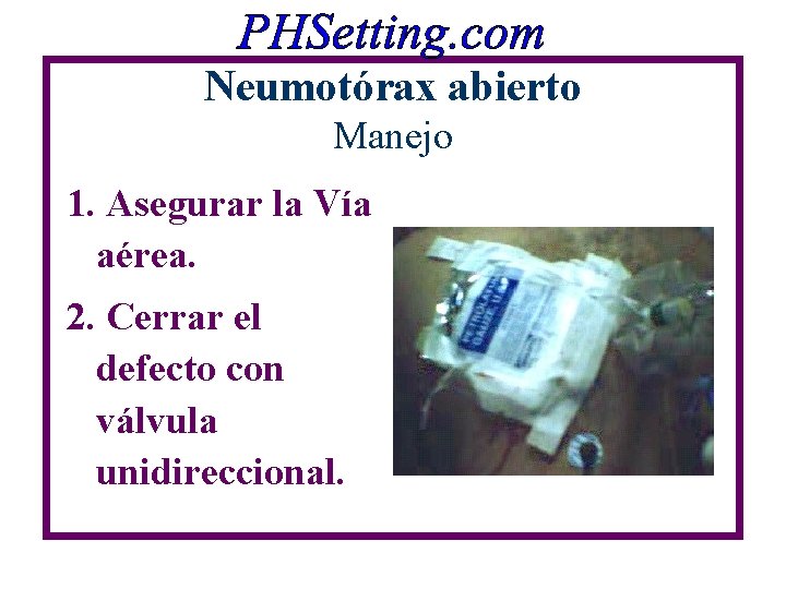 Neumotórax abierto Manejo 1. Asegurar la Vía aérea. 2. Cerrar el defecto con válvula Neumotórax abierto Manejo 1. Asegurar la Vía aérea. 2. Cerrar el defecto con válvula
