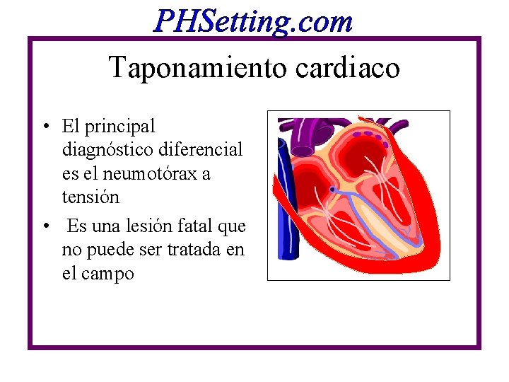 Taponamiento cardiaco • El principal diagnóstico diferencial es el neumotórax a tensión • Es Taponamiento cardiaco • El principal diagnóstico diferencial es el neumotórax a tensión • Es
